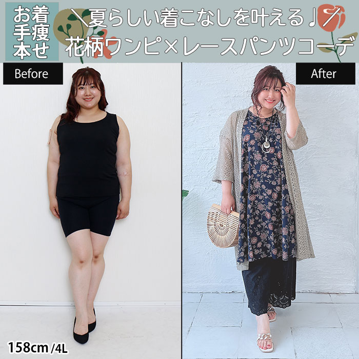 【夏らしい着こなしを叶える♩花柄ワンピ×レースパンツコーデ】